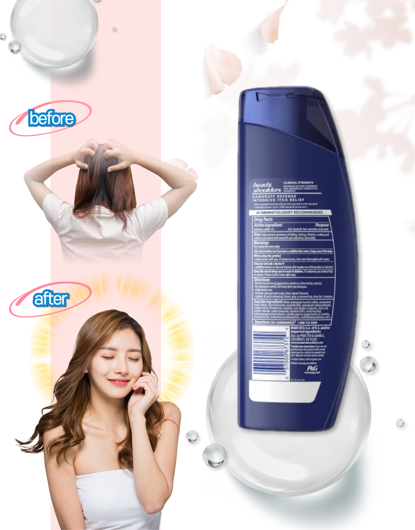 Head&Shoulders Clinical Dandruff Defense Intensive Itch Shampoo 400ml